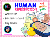 4 Year Pack - Complete Middle School PSHE + RSE