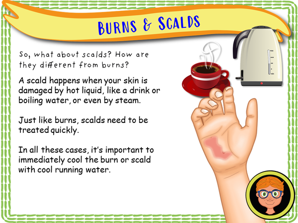 Scalds Year 3 - First Aid Part 1 - Burns and Scalds – EC Publishing