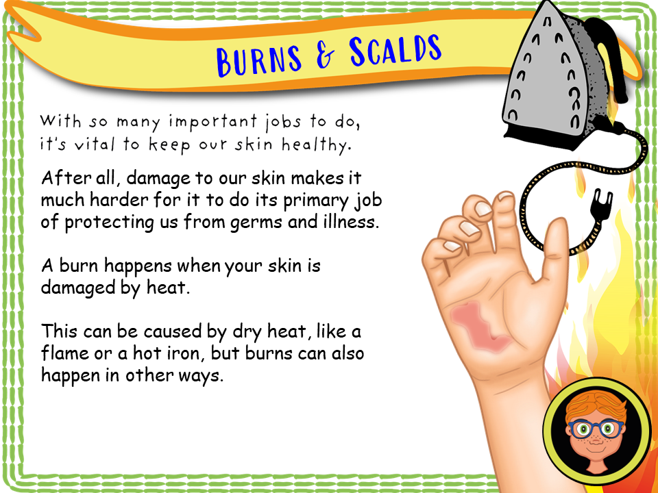 Scalds Year 3 - First Aid Part 1 - Burns and Scalds – EC Publishing