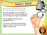 First Aid  Part 1 - Burns and Scalds