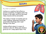 Year 4 - First Aid Part 3 - Asthma and Allergies